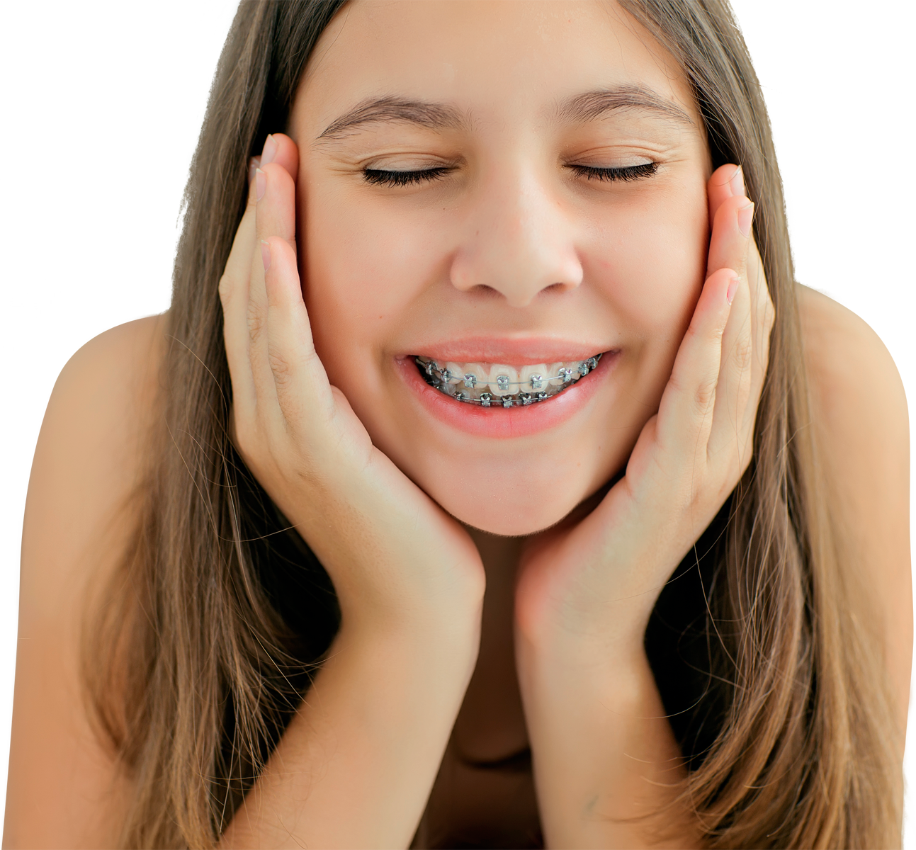 Introducing Damon Braces