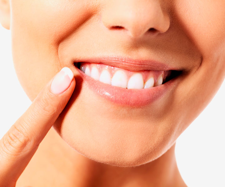 Braces Try It Today
